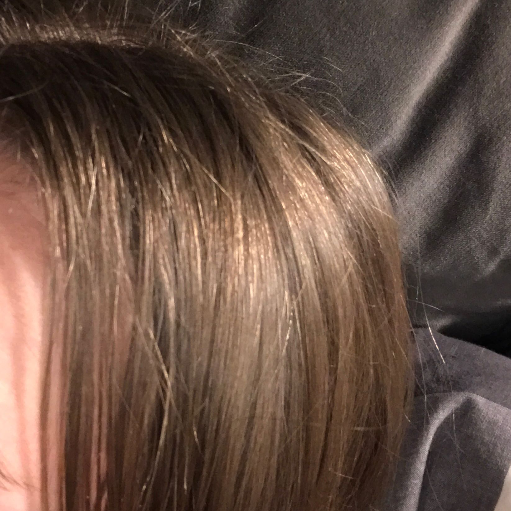 haare fetten extreem schnell