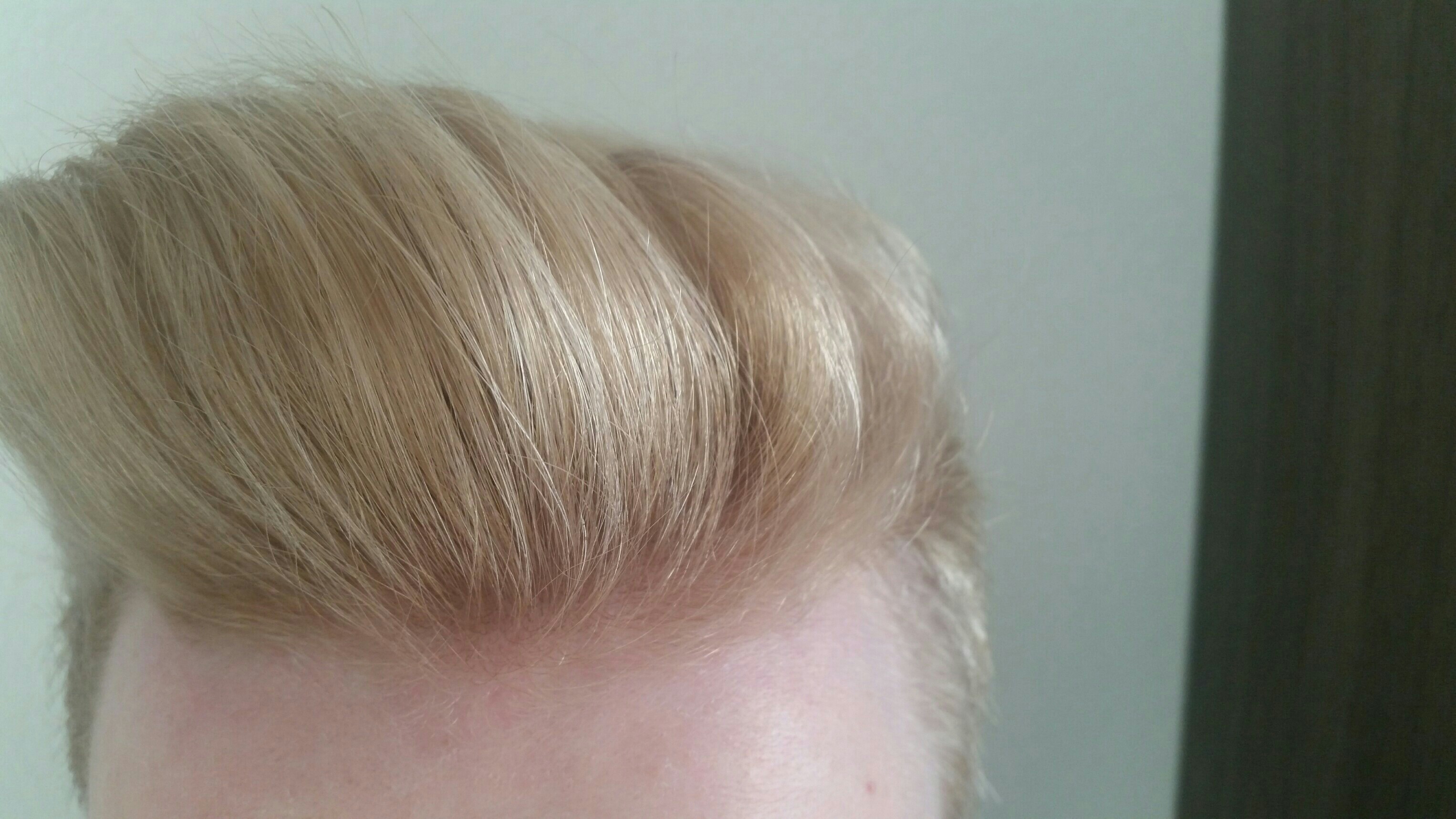 Haare Grau Farben Mit Alpecin Shampoo Blond