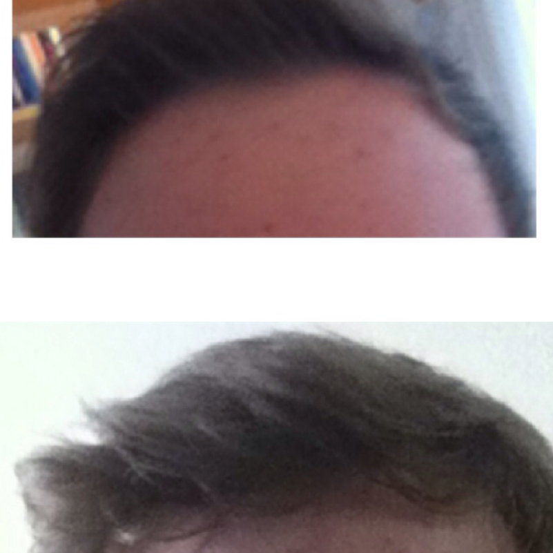 haare halten nicht was tun