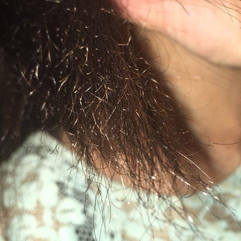 Meine Haarspitzen, wie gesagt kein Spliss jedoch geknickte Haare - (Haare, brüchig)