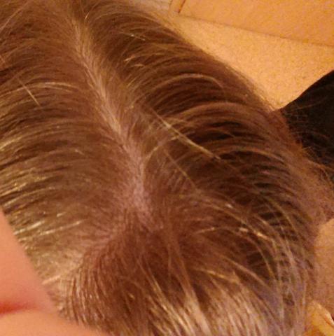 Hinterkopf haarwirbel Frisuren Für