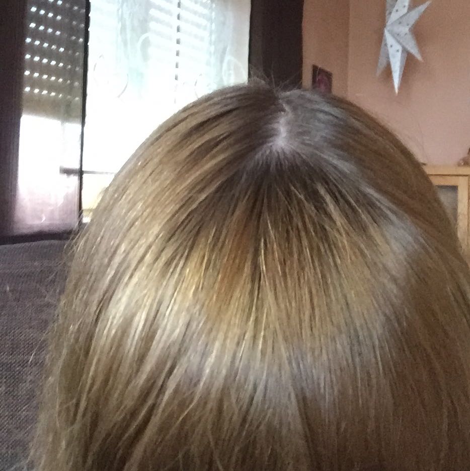 Grnstich Aus Den Haaren Bekommen Youtube