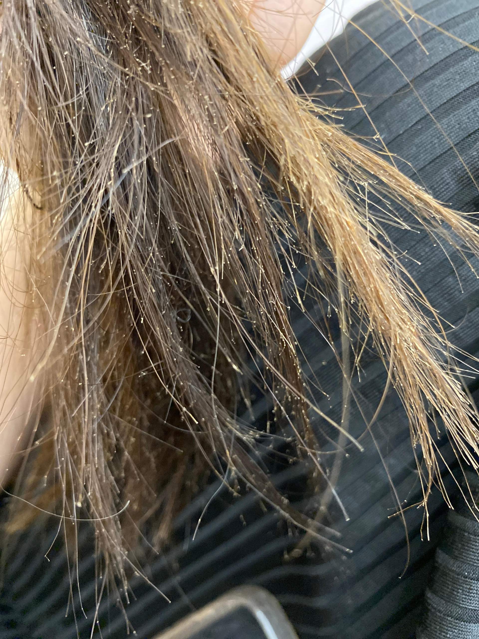 Haare retten? (Mädchen, Frauen, Männer)