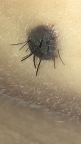 wieso wachsen da haare