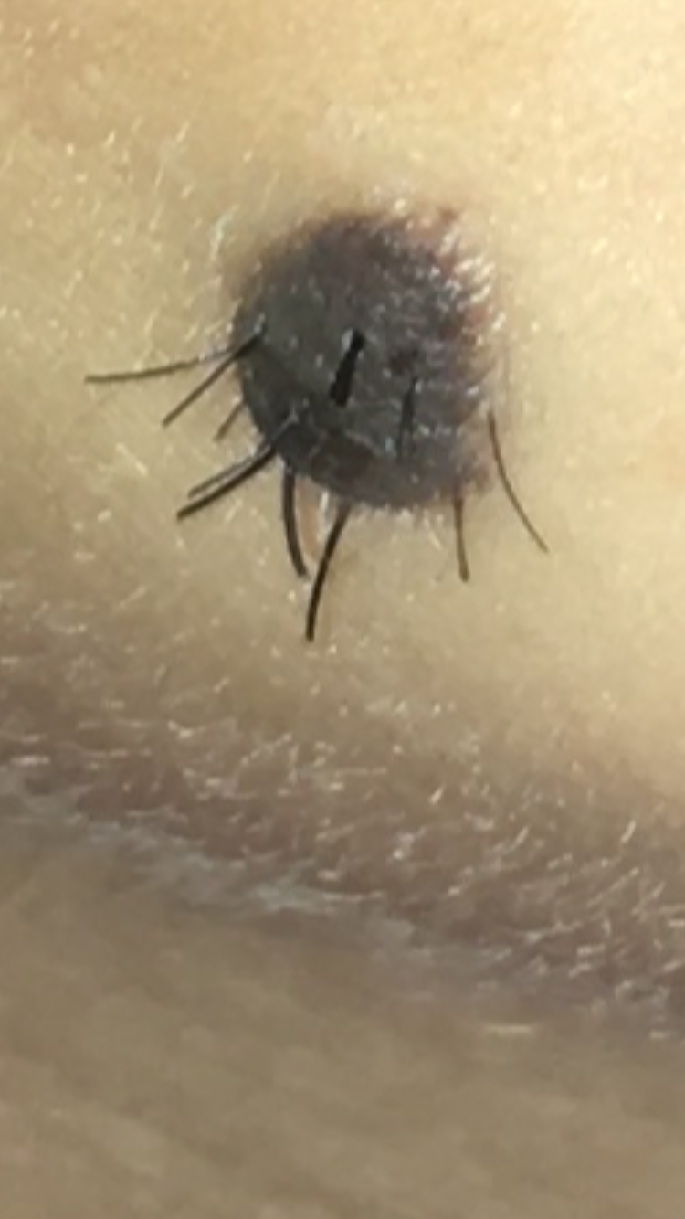 wieso wachsen da haare