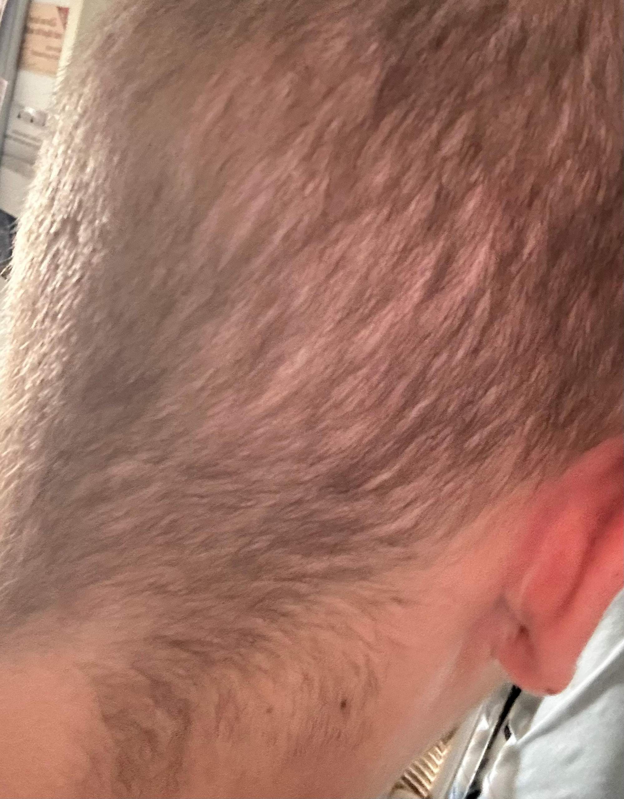Haare wachsen nach? (Mädchen, Frauen, Männer)