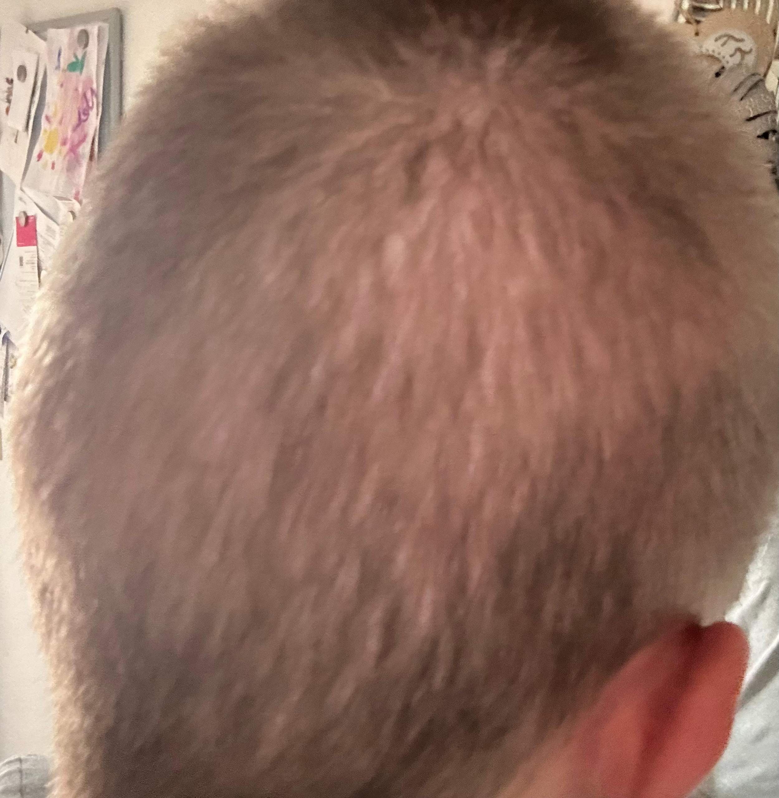 Haare wachsen nach? (Mädchen, Frauen, Männer)