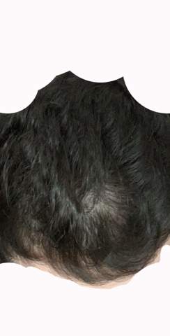 Haare Werden Immer Dunner Was Tun Gesundheit Und Medizin Haare Werden Immer Dunner Was Tun Gesundheit Und Medizin