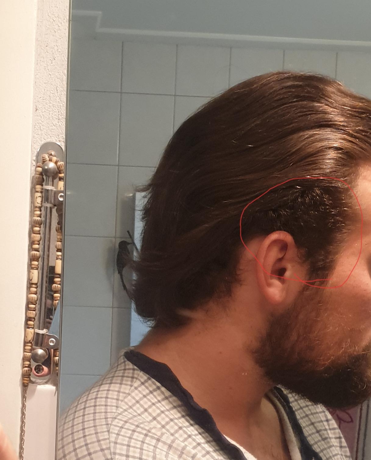 haaren wachsen an den seiten langsam