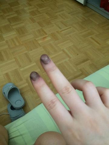 haarfarbe aus der haut entfernen