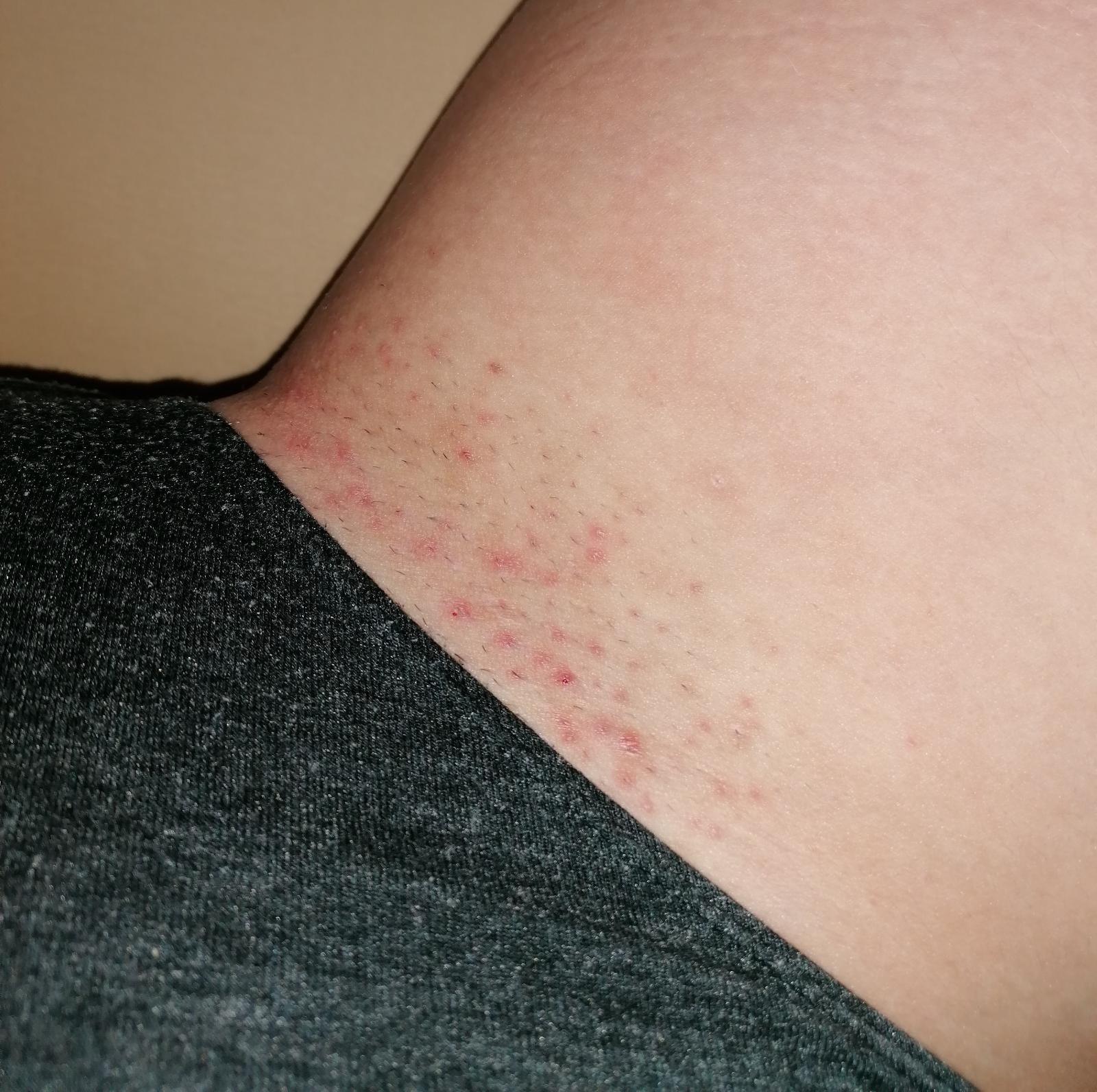 haarfreie bikinizone und achseln