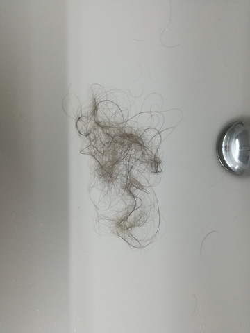 Haarverlust Nach Duschen Normal Haare Haarausfall