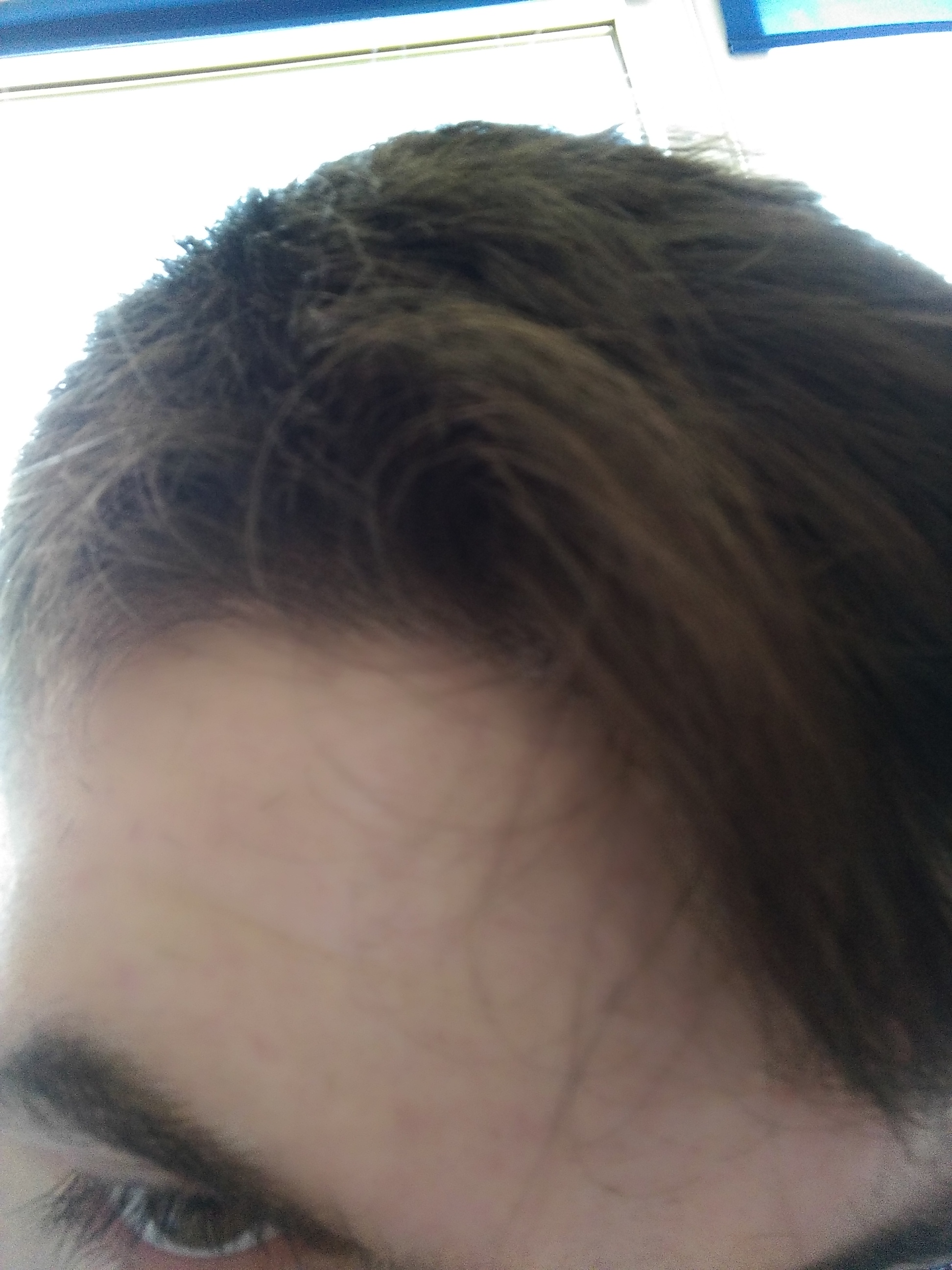 Haarwirbel Uber Der Stirn Haare Aussehen