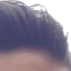 Haarwirbel Vorne Entfernen Wegkriegen Haare Wirbel