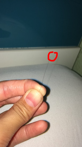 Haarwurzel Oder Nicht Haarausfall Haarwurzel Oder Nicht Haarausfall