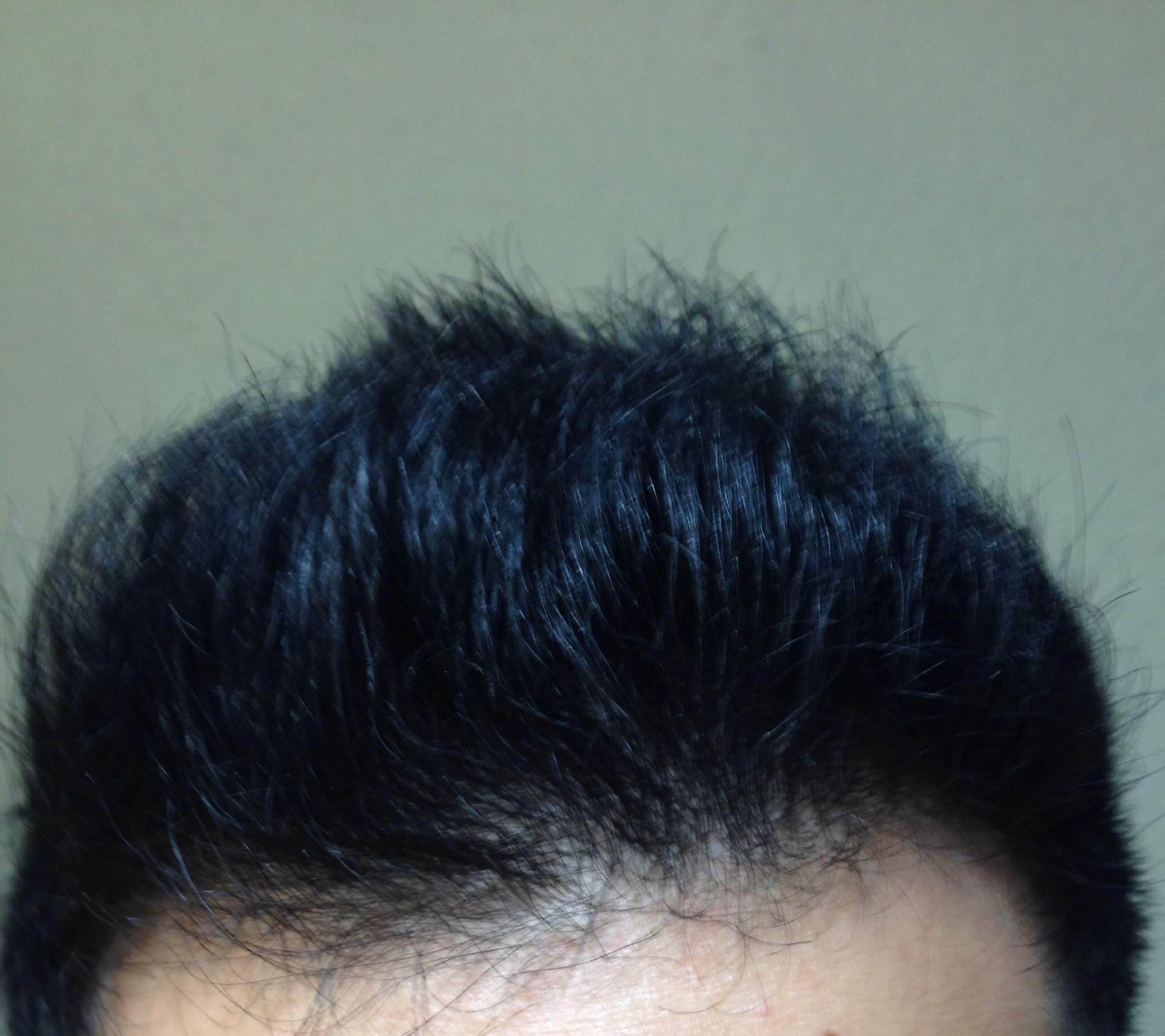 Haarwurzeln Geschwacht Durch Hitze Haare Beauty Aussehen Haarwurzeln Geschwacht Durch Hitze Haare Beauty Aussehen