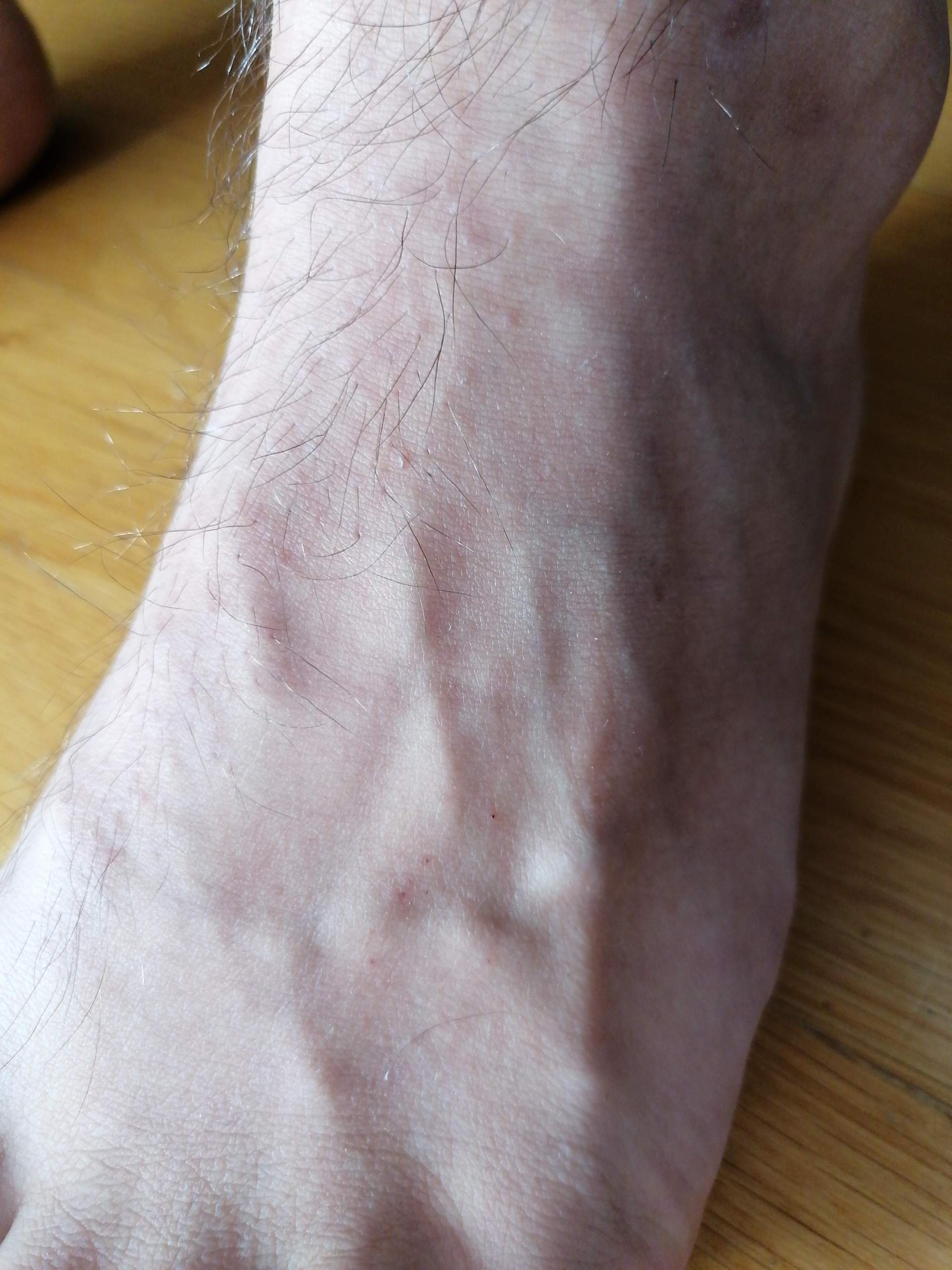 Hab extrem viele Adern am Fuß, ist das normal mit 15? (Gesundheit