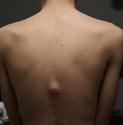 Hab Ich Eine Prellung Am Rucken Gesundheit Und Medizin Gesundheit Arzt Hab Ich Eine Prellung Am Rucken Gesundheit Und Medizin Gesundheit Arzt