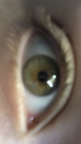 - (Augen, Augenfarbe)