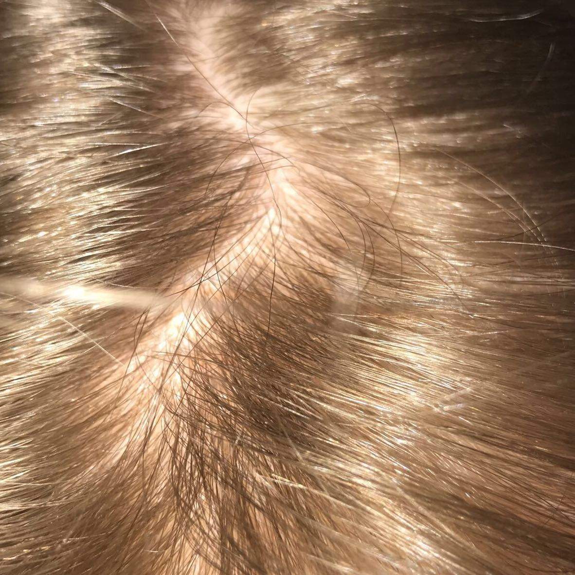 Hab ich Haarausfall mit 14? (Gesundheit und Medizin, Haare)