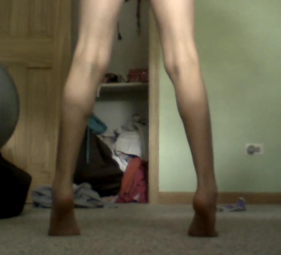 Hab Ich Kurze Oder Verkurzte Wadenmuskeln J1 Untersuchung Mit Foto Gesundheit Muskeln Beine Hab Ich Kurze Oder Verkurzte Wadenmuskeln J1 Untersuchung Mit Foto Gesundheit Muskeln Beine