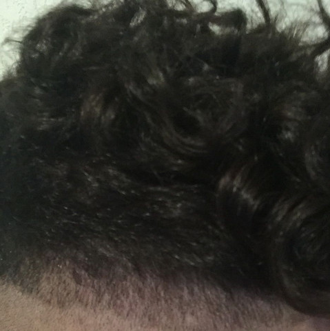 Hab Ich Locken j Gesundheit Sex Medizin