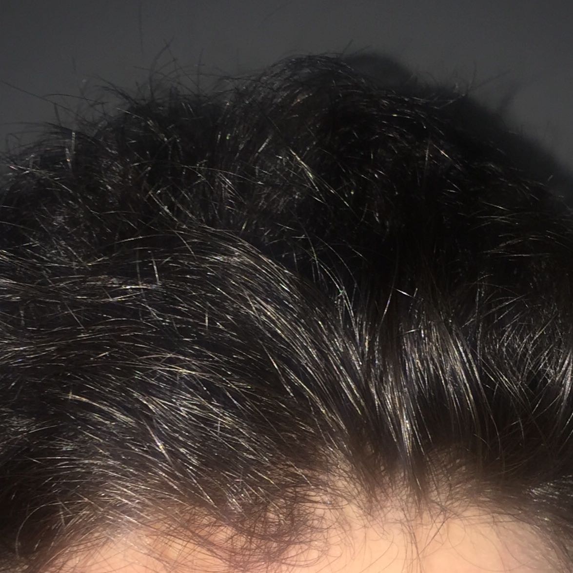 hab ich sehr dunne haare gesundheit