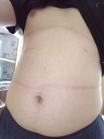 Hab Ich Wasser Im Bauch Hab Ich Wasser Im Bauch