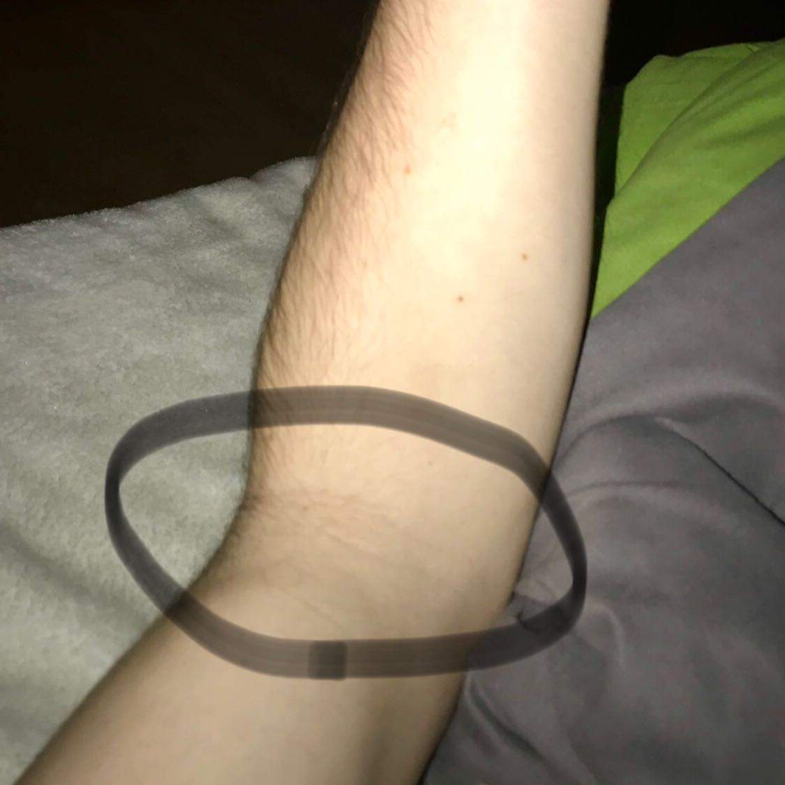 Hab Seit Gestern Abend Bis Jetzt Am Morgen Arm Schmerzen Also Mein Linker Arm Tut Weh Mein Arzt Hat Gesagt Das Mein Linker Brust Nur Schmerzt Weil Ich Gesundheit Und Medizin Tod Hab Seit Gestern Abend Bis Jetzt Am Morgen Arm Schmerzen Also Mein Linker Arm Tut Weh Mein Arzt Hat Gesagt Das Mein Linker Brust Nur Schmerzt Weil Ich Gesundheit Und Medizin Tod