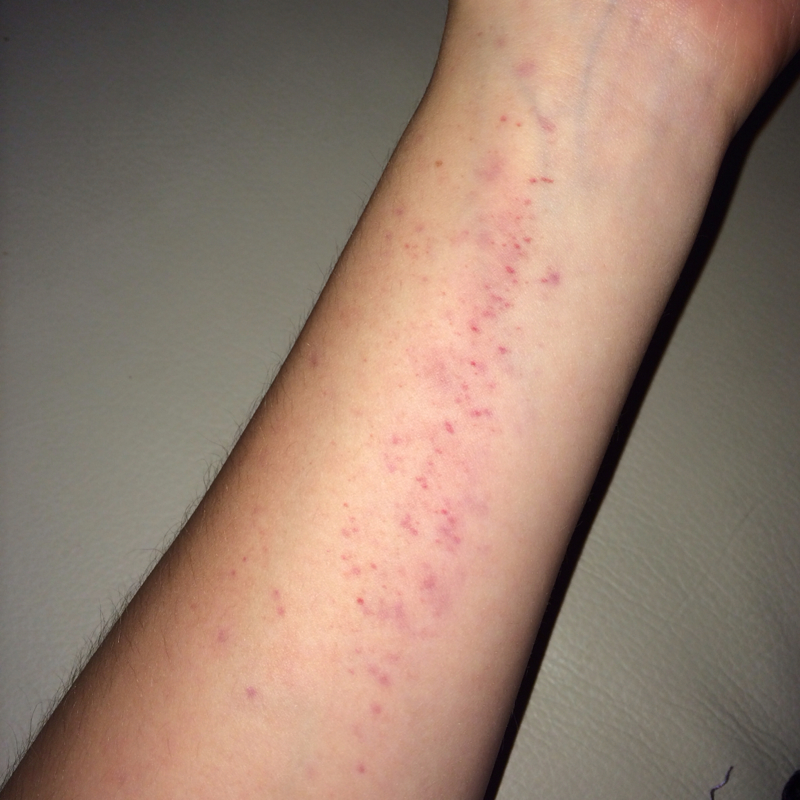 Habe aua! (Sport, Arm, Volleyball) Habe aua! (Sport, Arm, Volleyball)