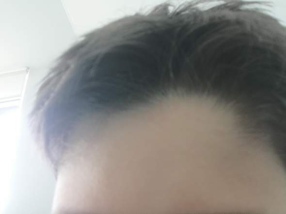 Habe Einen Wirbel An Der Rechten Seite Von Meinen Haaren Wie Kriege Ich Den Weg Haare Beauty Frisur