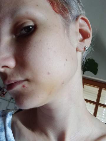 Bild zum Beitrag