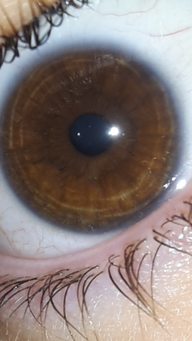 Ist Es Schlimm Grune Ringe In Der Iris Zu Haben Augen Ring Ist Es Schlimm Grune Ringe In Der Iris Zu Haben Augen Ring