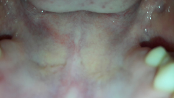 - (AIDS, ..h)