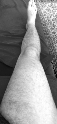 Foto 1 - (fett, Beine, übergewicht)