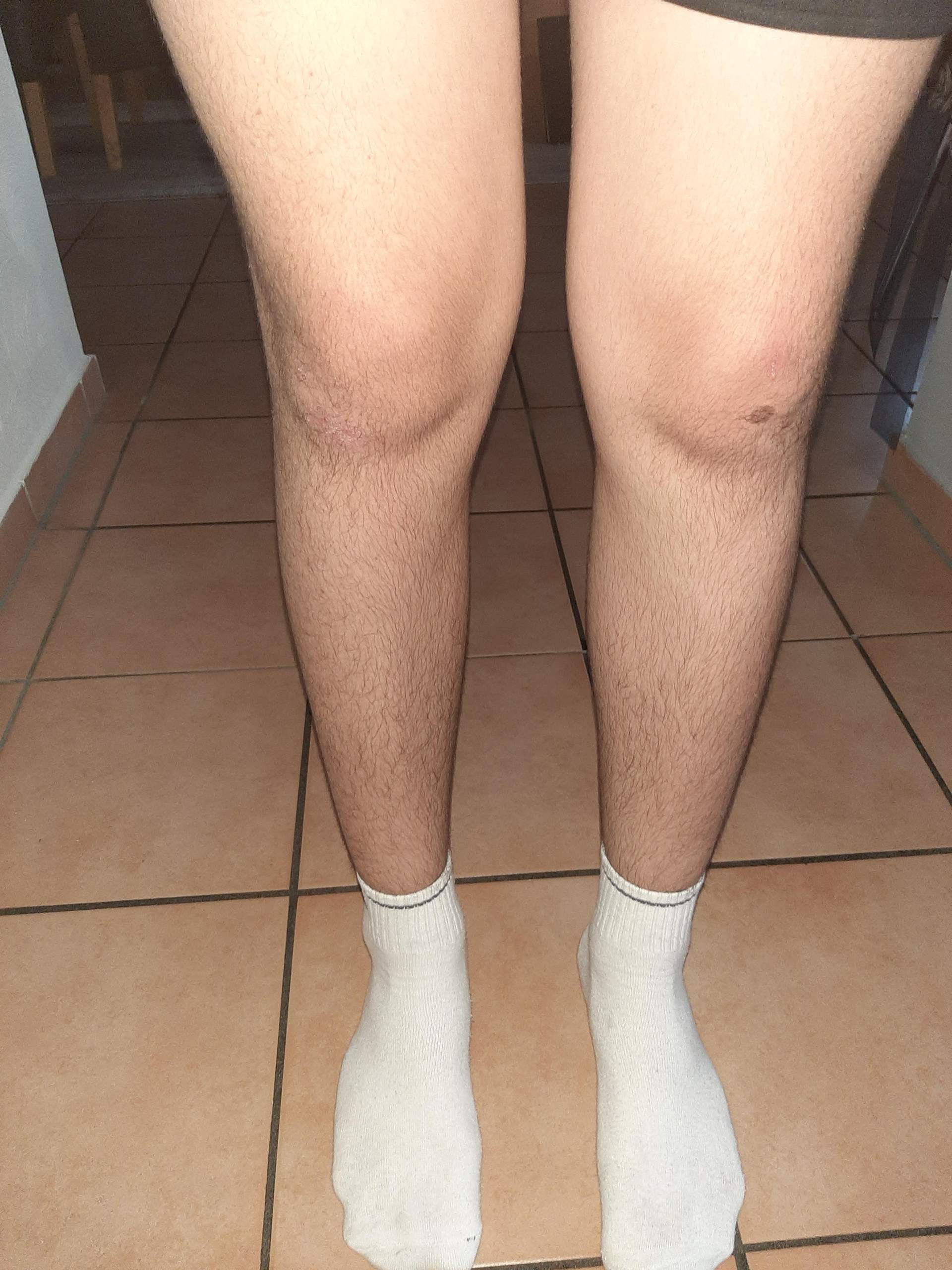 Habe ich dicke Beine? (Sport und Fitness)