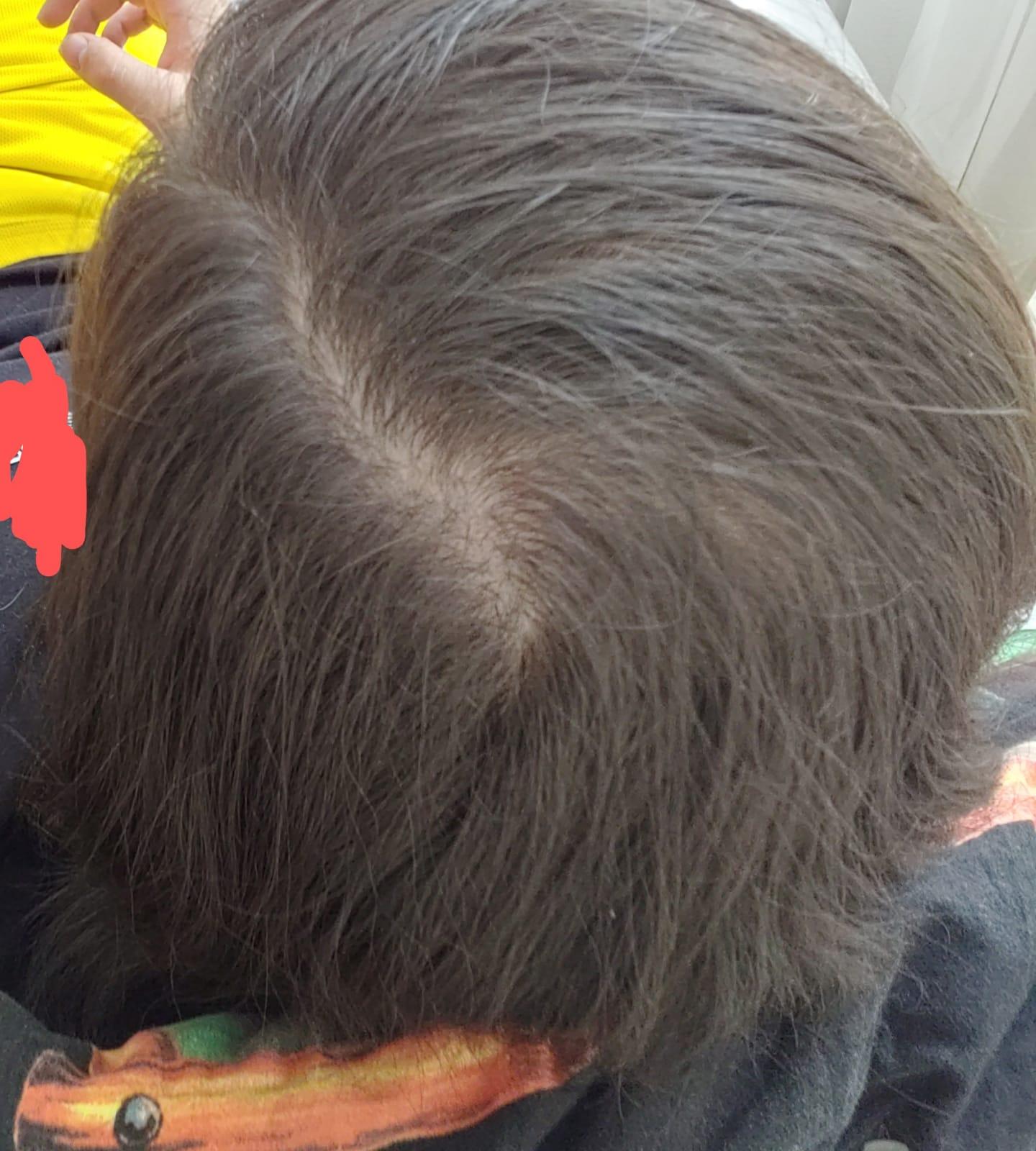 habe ich dunne haare oder haarausfall