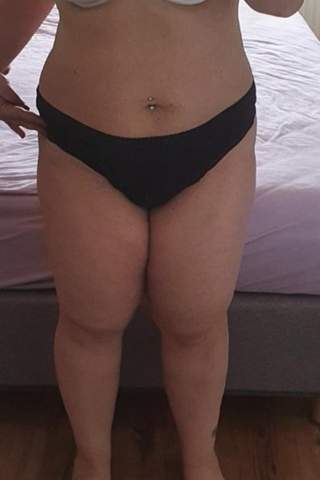 Habe Ich Ein Lipodem In Den Beinen Gesundheit Und Medizin Beine Habe Ich Ein Lipodem In Den Beinen Gesundheit Und Medizin Beine
