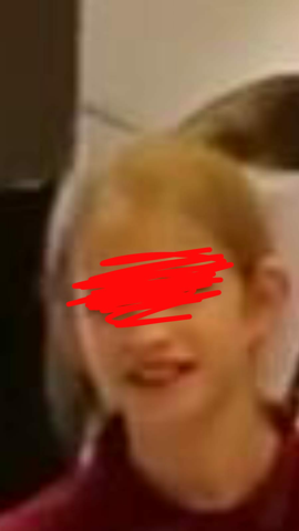 Habe Ich Ein Rundes Oder Ein Kantiges Spitzes Kinn Gesundheit Und Medizin