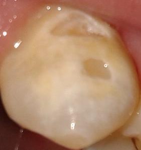 Habe ich ein Zahnproblem? (Gesundheit, Zähne, Zahnarzt)