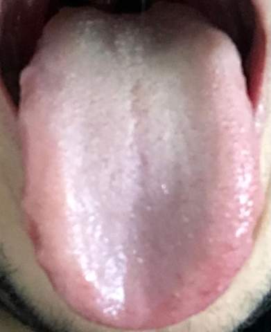 Habe Ich Eine Gesunde Zunge Gesundheit Und Medizin Habe Ich Eine Gesunde Zunge Gesundheit Und Medizin