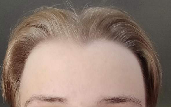 Habe ich eine große oder eine normale Stirn, interessiert mich mal?