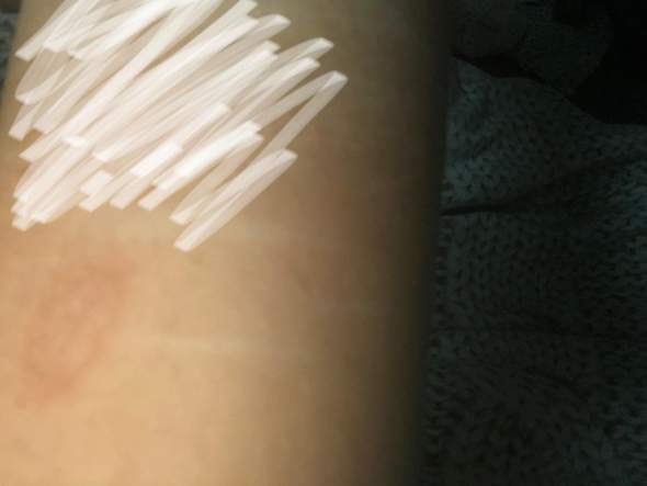 - (Gesundheit und Medizin, Haut, Hautpflege)