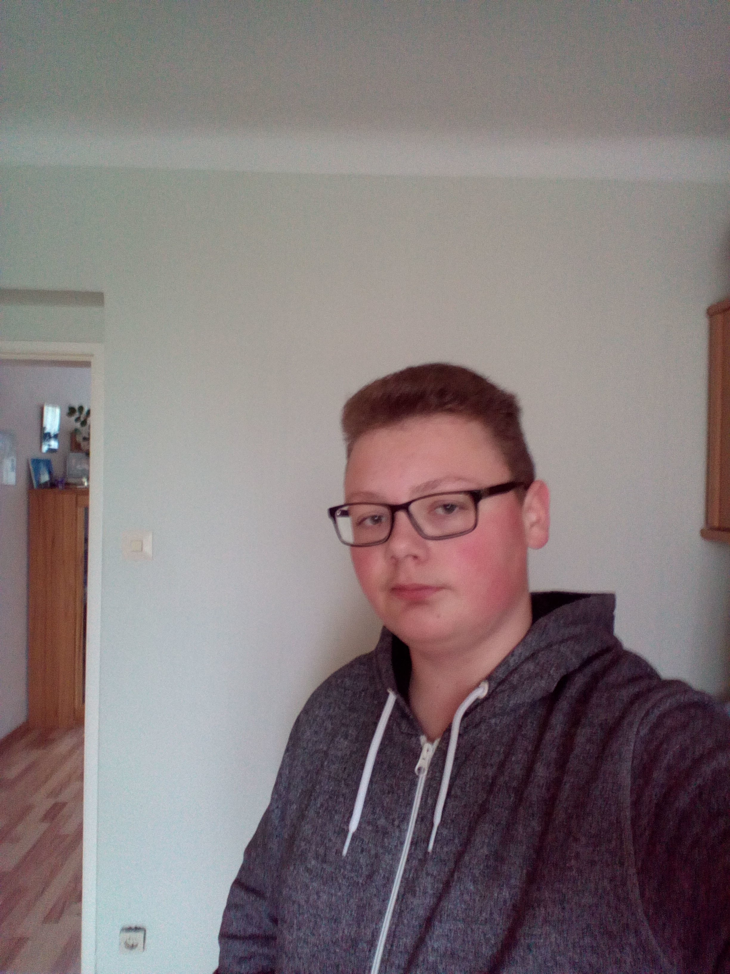 Habe Ich Eine Sehr Hohe Stirn Foto Kopf