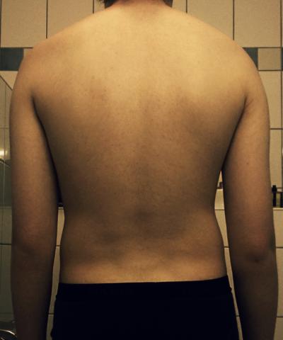 Rücken  - (Gesundheit, Jungs, Körper)