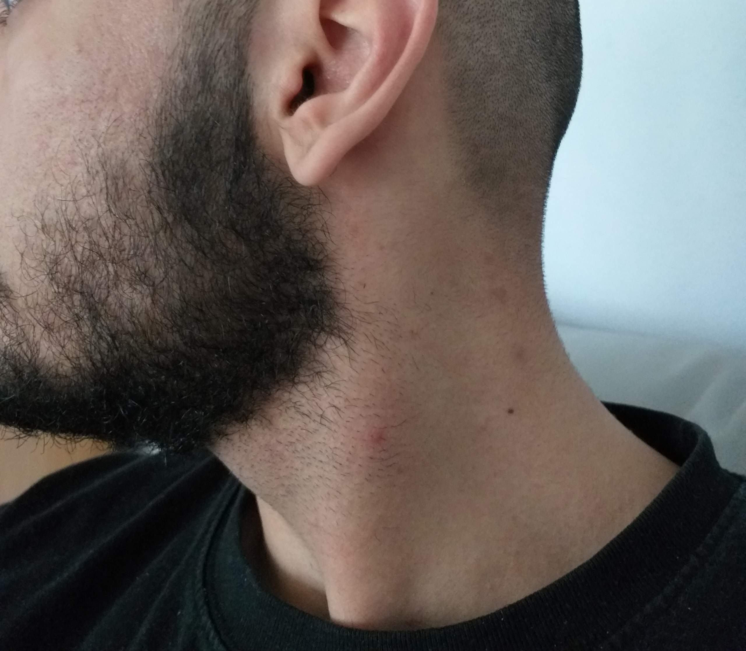 Habe ich einen Vollbart oder nicht? (Haare, Bart, Bartwuchs) - 2 Full Habe ich einen Vollbart oder nicht? (Haare, Bart, Bartwuchs) - 2 Full