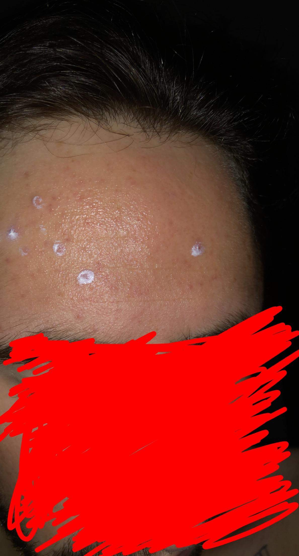 Habe ich fettige Haut & großporig? (Beauty, Pflege, Kosmetik)