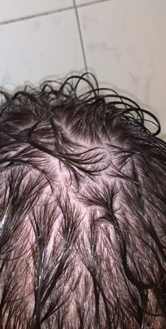 Haare kopfhaut sichtbar dünne Cornrows dünnes
