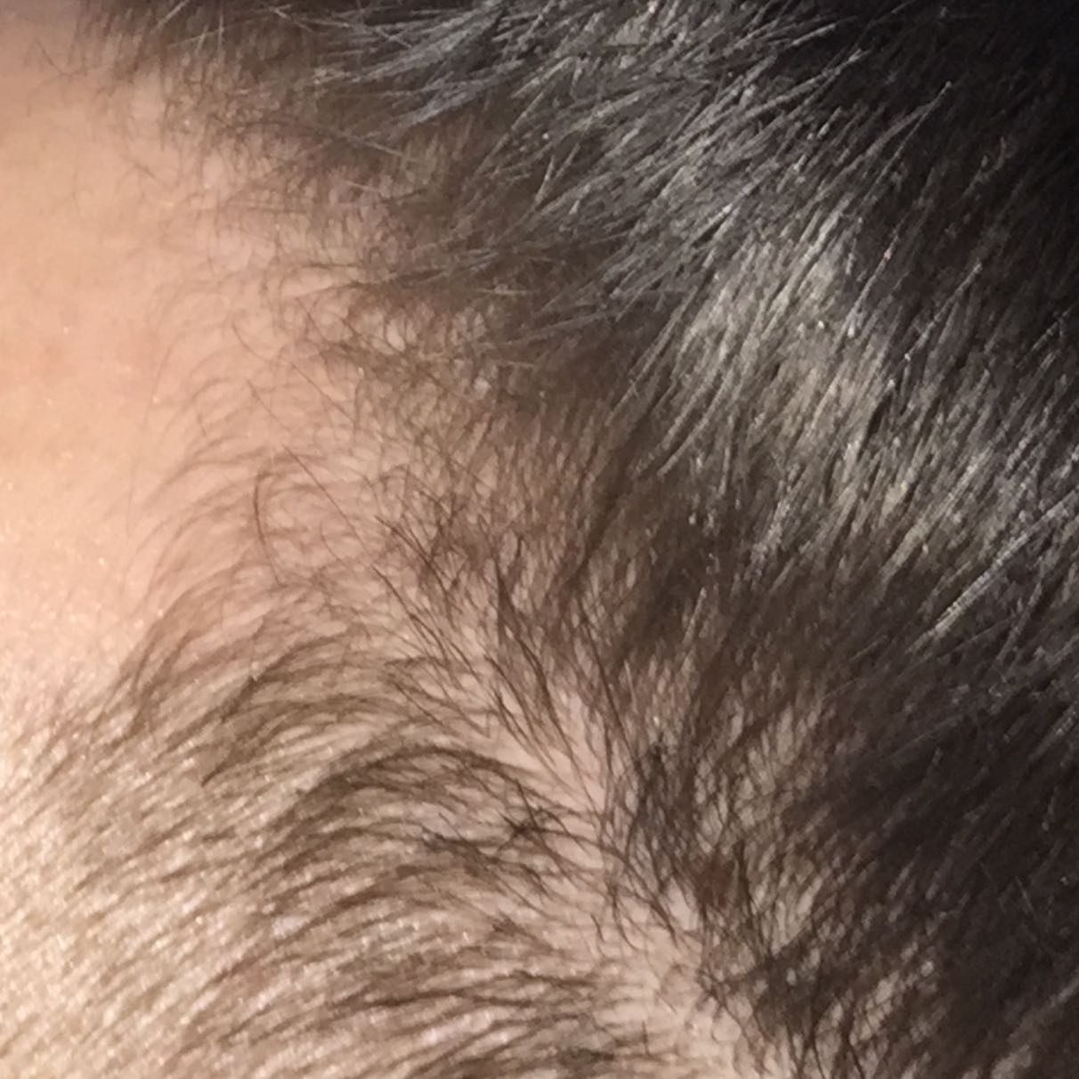 extremer haarbruch nach blondierung