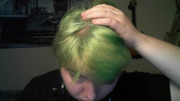 Subjekt A - (Haare, Haarausfall)